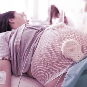 Obstetric malpractice: an update